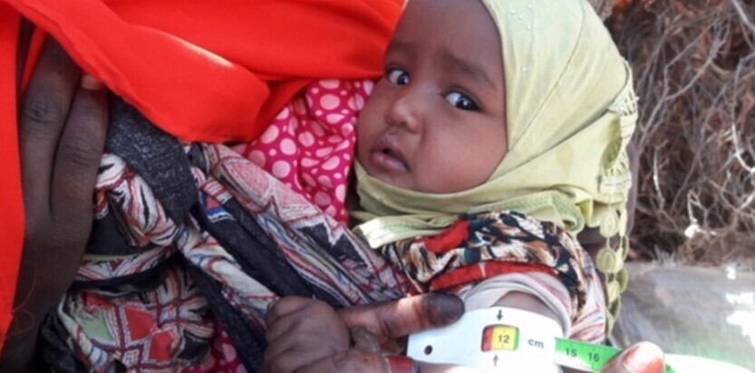 Dank medizinischer Aufbaunahrung hat Aisha wieder eine Chance Dank medizinischer Aufbaunahrung hat Aisha wieder eine Chance