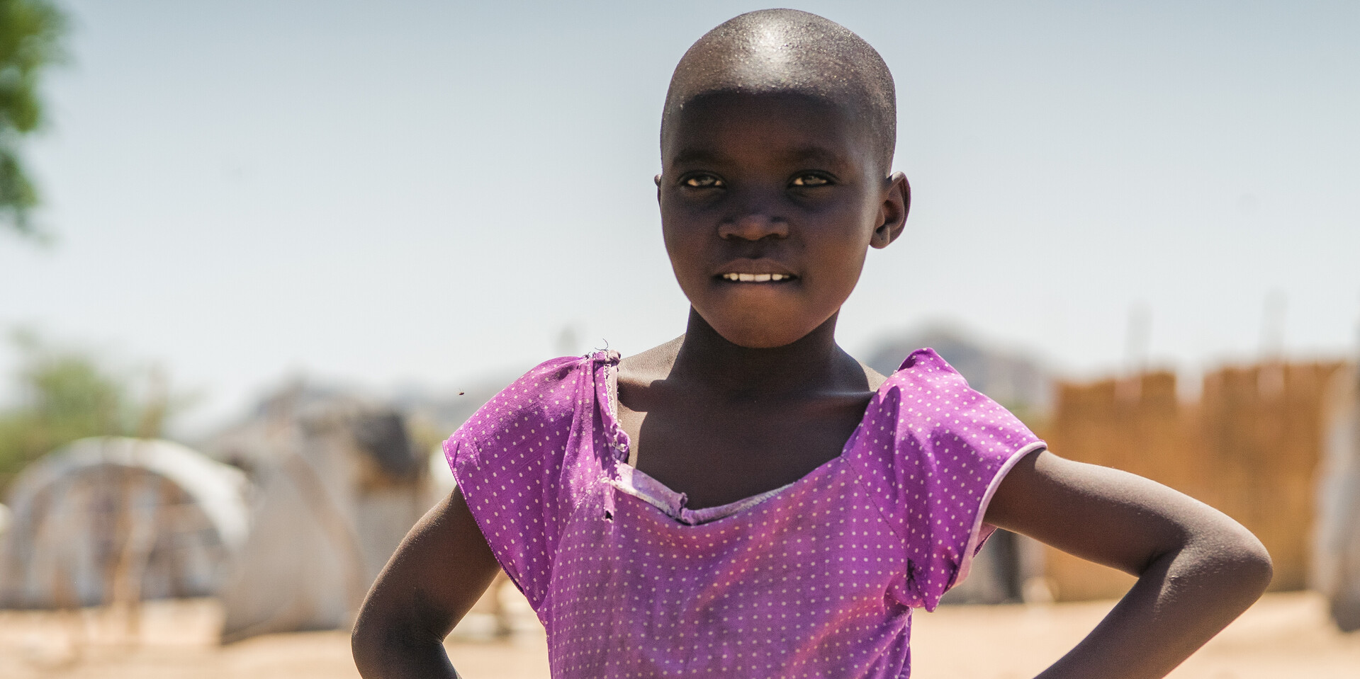 Ein Mädchen im Südsudan. Auch dort ist Genitalverstümmelung verbreitet Ein Mädchen im Südsudan. Auch dort ist Genitalverstümmelung verbreitet