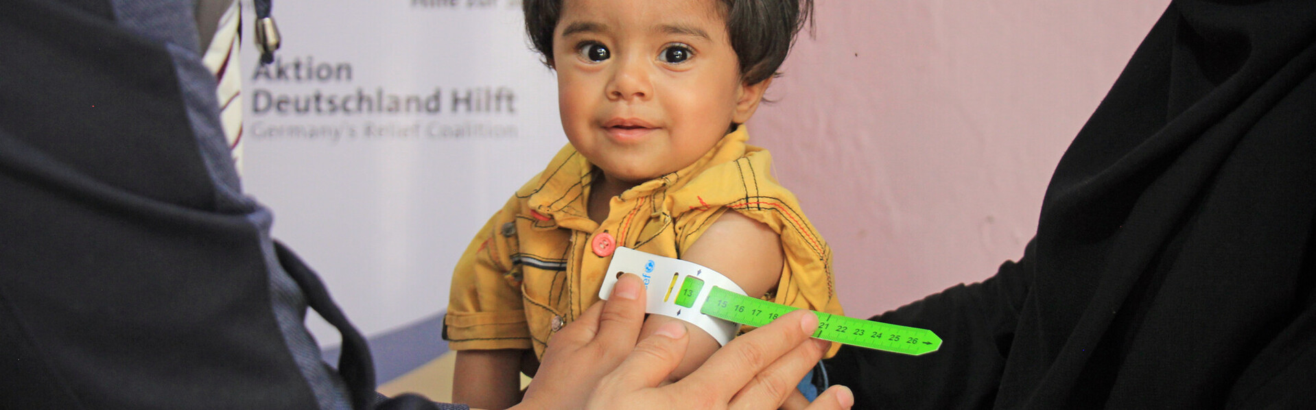 Einem Kind in Syrien wird der Oberarmumfang gemessen Einem Kind in Syrien wird der Oberarmumfang gemessen