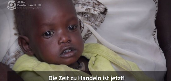 Ein Baby liegt in Bett im Südsudan in Afrika. Es ist betroffen von der Hungerkatastrophe in Afrika. Ein Baby liegt in Bett im Südsudan in Afrika. Es ist betroffen von der Hungerkatastrophe in Afrika.