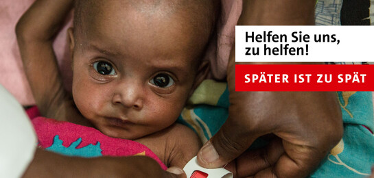 Ein Kind in Somaliland droht zu sterben - wie viele Kinder während der Hungersnot in Afrika Ein Kind in Somaliland droht zu sterben - wie viele Kinder während der Hungersnot in Afrika