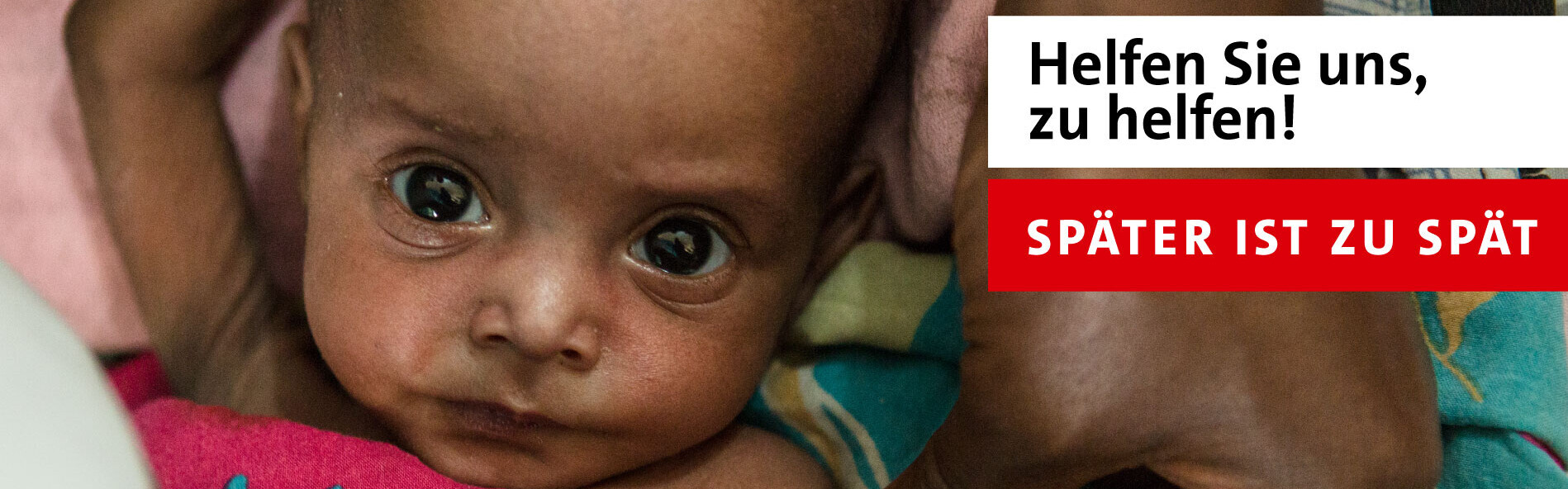 Ein Kind in Somaliland droht zu sterben - wie viele Kinder während der Hungersnot in Afrika Ein Kind in Somaliland droht zu sterben - wie viele Kinder während der Hungersnot in Afrika